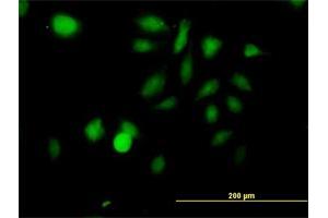 Immunofluorescence of purified MaxPab antibody to STK3 on HeLa cell. (STK3 anticorps  (AA 1-491))