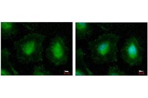 ICC/IF Image EIF3K antibody detects EIF3K protein at cytoplasm and nucleus by immunofluorescent analysis.