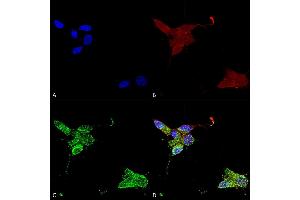 Immunocytochemistry/Immunofluorescence analysis using Mouse Anti-TrpM7 Monoclonal Antibody, Clone S74 (ABIN2483118).