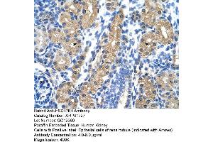 Rabbit Anti-HSD17B1 Antibody  Paraffin Embedded Tissue: Human Kidney Cellular Data: Epithelial cells of renal tubule Antibody Concentration: 4. (HSD17B1 anticorps  (N-Term))