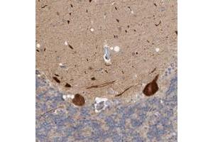 Immunohistochemical staining of human cerebellum with ZNF804B polyclonal antibody  shows strong cytoplasmic positivity in Purkinje cells at 1:200-1:500 dilution. (ZNF804B anticorps)