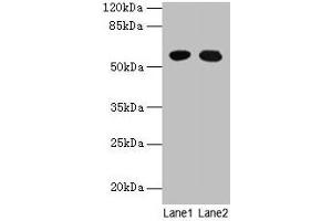 Western blot All lanes: GTPBP6 antibody at 6 μg/mL Lane 1: A549 whole cell lysate Lane 2: Hela whole cell lysate Secondary Goat polyclonal to rabbit IgG at 1/10000 dilution Predicted band size: 57 kDa Observed band size: 57 kDa (GTPBP6 anticorps  (AA 146-295))