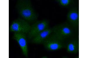 A549 cells were stained with Glycogen synthase 1(S641) (10C1) Monoclonal Antibody  at 1:200 followed by secondary antibody incubation, DAPI staining of the nuclei and detection.