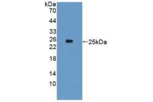 Detection of Recombinant CYP26A1, Human using Polyclonal Antibody to Cytochrome P450 26A1 (CYP26A1) (CYP26A1 anticorps  (AA 73-255))