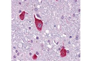 Anti-PTH2R / PTHR2 antibody  ABIN1049269 IHC staining of human brain, neurons and glia.