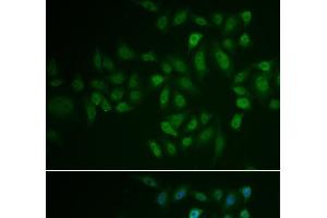 Immunofluorescence analysis of U2OS cells using MYLK3 Polyclonal Antibody (MYLK3 anticorps)