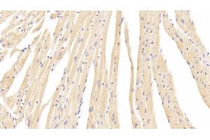 Detection of CACNa1C in Mouse Cardiac Muscle Tissue using Polyclonal Antibody to Calcium Channel, Voltage Dependent, L-Type, Alpha 1C Subunit (CACNa1C)
