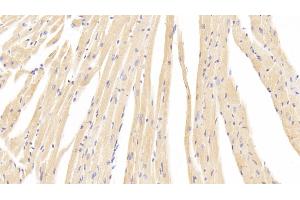 Detection of CACNa1C in Mouse Cardiac Muscle Tissue using Polyclonal Antibody to Calcium Channel, Voltage Dependent, L-Type, Alpha 1C Subunit (CACNa1C) (CACNA1C anticorps  (AA 1978-2139))