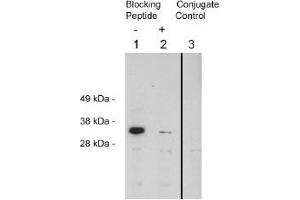 Image no. 1 for anti-Four and A Half LIM Domains 2 (FHL2) antibody (ABIN265171) (FHL2 anticorps)