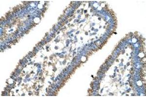 Immunohistochemical staining (Formalin-fixed paraffin-embedded sections) of human intestine with CPS1 polyclonal antibody  at 4-8 ug/mL working concentration. (CPS1 anticorps  (N-Term))