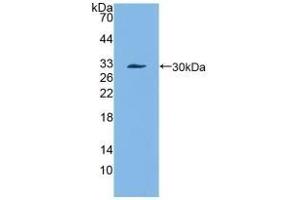 Detection of Recombinant a1ACT, Mouse using Polyclonal Antibody to Alpha-1-Antichymotrypsin (a1ACT) (a1-Antichymotrypsin (AA 23-253) anticorps)