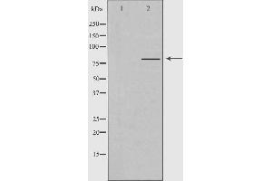 Western blot analysis of extracts from Jurkat cells, using PJA2 antibody. (PJA2 anticorps)