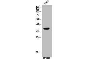 Western Blot analysis of COLO cells using Phospho-VDR (S51) Polyclonal Antibody (Vitamin D Receptor anticorps  (pSer51))