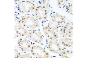 Immunohistochemistry of paraffin-embedded human stomach using THOC1 antibody (ABIN5974800) at dilution of 1/100 (40x lens). (THOC1 anticorps)
