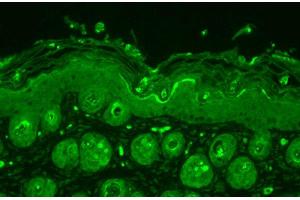 Immunohistochemistry analysis using Rabbit Anti-Ubiquitin Polyclonal Antibody .