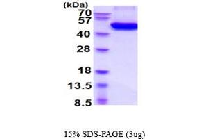Basic Transcription Factor 3 Pseudogene 11 (BTF3P11) (AA 22-401) protein (His tag)
