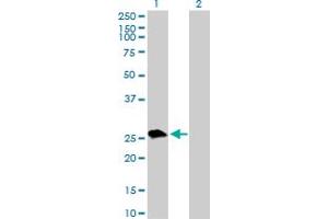 Western Blot analysis of UROS expression in transfected 293T cell line by UROS MaxPab polyclonal antibody. (UROS anticorps  (AA 1-265))