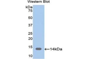 Detection of Recombinant CAP1, Human using Polyclonal Antibody to Adenylyl Cyclase Associated Protein 1 (CAP1)