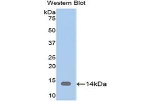Detection of Recombinant CAP1, Human using Polyclonal Antibody to Adenylyl Cyclase Associated Protein 1 (CAP1) (CAP1 anticorps  (AA 38-149))
