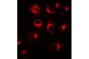 Immunofluorescent analysis of BCL10 staining in A549 cells. (BCL10 anticorps)