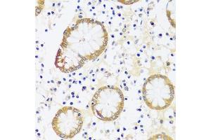 Immunohistochemistry of paraffin-embedded human stomach using CaMKI antibody (ABIN7266017) at dilution of 1:100 (40x lens).