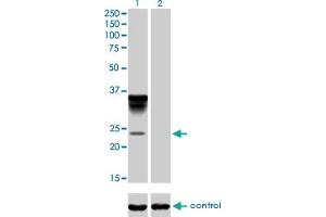 Western blot analysis of ORM1 over-expressed 293 cell line, cotransfected with ORM1 Validated Chimera RNAi (Lane 2) or non-transfected control (Lane 1). (ORM1 anticorps  (AA 18-201))