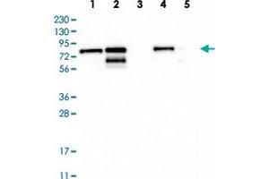 Western blot analysis of Lane 1: RT-4, Lane 2: U-251 MG, Lane 3: Human Plasma, Lane 4: Liver, Lane 5: Tonsil with TMTC2 polyclonal antibody  at 1:250-1:500 dilution. (TMTC2 anticorps)