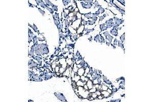 IHC analysis of eRF1/ETF1 using anti-eRF1/ETF1 antibody (ABIN7602626). (ETF1 anticorps  (AA 9-342))