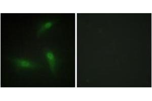 Immunofluorescence analysis of HeLa cells, using hnRNP A1 Antibody.
