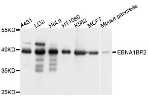 Western blot analysis of extracts of various cell lines, using EBNA1BP2 antibody. (EBNA1BP2 anticorps  (AA 1-306))