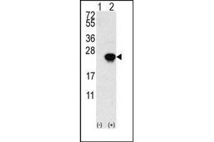 Western blot analysis of FGF1 (arrow) using rabbit polyclonal FGF1 Antibody (FGF1 anticorps  (N-Term))