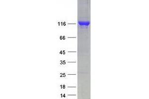 Validation with Western Blot