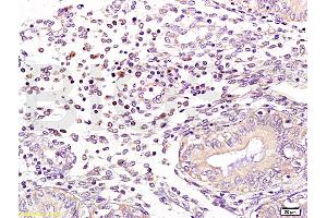Formalin-fixed and human endometrium tissue labeled with Anti-NCF1/p47 phox Polyclonal Antibody, Unconjugated (ABIN750643) at 1:100 followed by conjugation to the secondary antibody and DAB staining