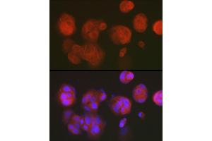 Immunofluorescence analysis of MCF7 cells using DNPH1 Rabbit mAb (ABIN7266383) at dilution of 1:50 (40x lens). (RCL anticorps)