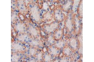 Used in DAB staining on fromalin fixed paraffin- embedded Kidney tissue