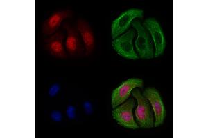 ABIN6256592 and ABIN6267253 staining Hela cells(4h of LPS treatment) by IF/ICC.