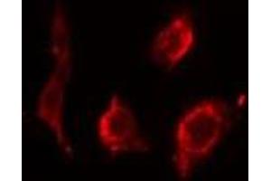 ABIN6275545 staining HeLa cells by IF/ICC. (PPP2R2B anticorps  (Internal Region))