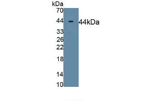 Detection of Recombinant MYH11, Rat using Polyclonal Antibody to Myosin Heavy Chain 11, Smooth Muscle (MYH11)