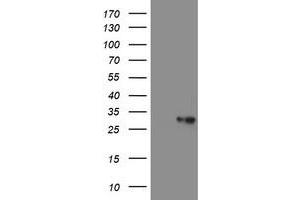 Image no. 2 for anti-Prefoldin Subunit 3 (PFDN3) antibody (ABIN1501700) (VBP1 anticorps)