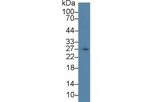 Detection of SCGN in Porcine Stomach lysate using Polyclonal Antibody to Secretagogin (SCGN)