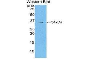 Western Blotting (WB) image for anti-Interferon Regulatory Factor 4 (IRF4) (AA 175-433) antibody (ABIN3206122) (IRF4 anticorps  (AA 175-433))
