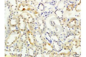 Formalin-fixed and paraffin embedded rat kidney labeled with Anti- NCX2/SLC8A2 Polyclonal Antibody, Unconjugated  at 1:200 followed by conjugation to the secondary antibody and DAB staining (SLC8A2 anticorps  (AA 601-700))