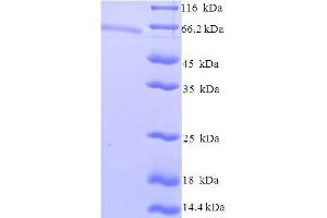 SDS-PAGE (SDS) image for Zinc Finger and SCAN Domain Containing 20 (ZSCAN20) (AA 1-433), (Isoform 4) protein (His-SUMO Tag) (ABIN5710658)