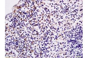 Formalin-fixed and paraffin embedded rat spleen labeled with Rabbit Anti-LPA2 Polyclonal Antibody, Unconjugated (ABIN2177376) at 1:200 followed by conjugation to the secondary antibody and DAB staining