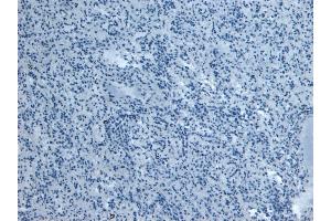 (ABIN184738) Negative Control showing staining of paraffin embedded Human Spleen, with no primary antibody.