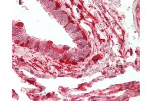 Human Lung, Respiratory Epithelium: Formalin-Fixed, Paraffin-Embedded (FFPE).