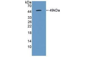 Detection of Recombinant IL10, Canine using Polyclonal Antibody to Interleukin 10 (IL10) (IL-10 anticorps  (AA 21-181))