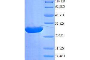 SDS-PAGE (SDS) image for Agouti Related Protein Homolog (Mouse) (AGRP) (AA 21-132) protein (His-SUMO Tag) (ABIN5709009)