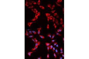 Immunofluorescence analysis of U2OS cells using EIF4B antibody. (EIF4B anticorps)