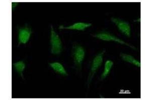Immunostaining analysis in HeLa cells.